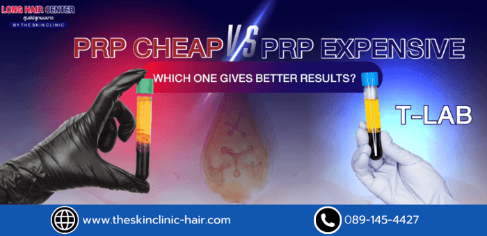 PRP Cheap vs. PRP Expensive