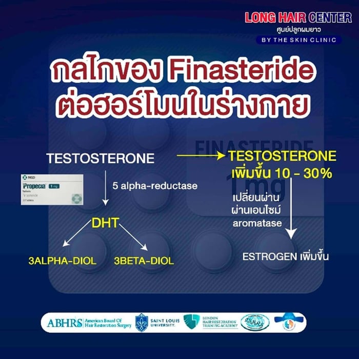 finasteride333.jpg