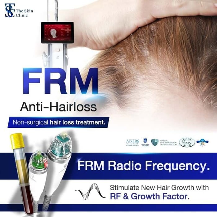 FRM (Fractional RF Microneedle)