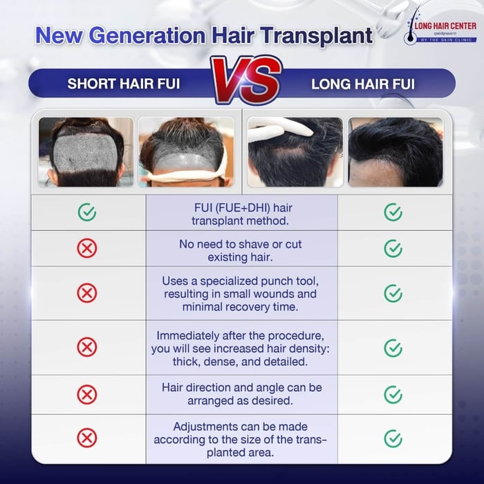 Demands a high level of expertise, as the long hair grafts are delicate and require careful handling to prevent dislodging.