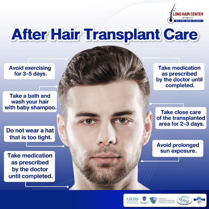 How to Care for Your Hair After Transplantation