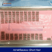 5 Truths About Long Hair Transplant You May Have Misunderstood!