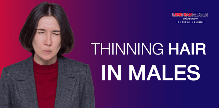 Thinning hair on the middle of the scalp : This can be noticed from the abnormal hair parting which, parted hair will become wider overtime and gradually, reveal a visible scalp. It can continue to expand from the center while the hair on the back of the scalp remains thick and perfectly normal. Thinning hair all over the scalp : This can be noticed by the hair strand’s appearance around the frontal (area near the forehead), the middle and the back of the scalp which is small and thin.