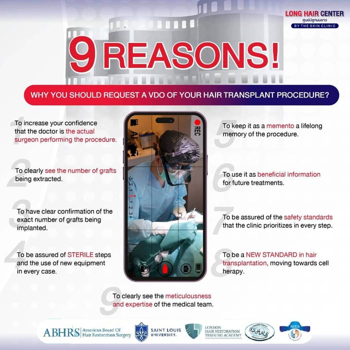 How to know the exact graft count and avoid being misled