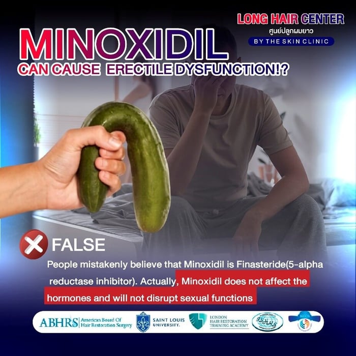 Why does using Minoxidil cause even more hair loss?