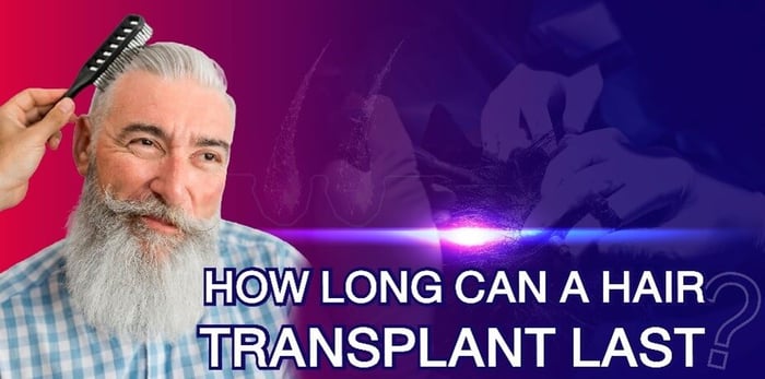 How long can a hair transplant last?