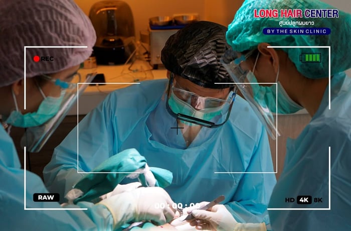 Is an Affordable Hair Transplant Really Possible?