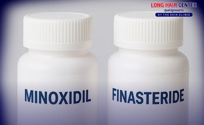 Minoxidil vs. Finasteride: Which One Is Better?