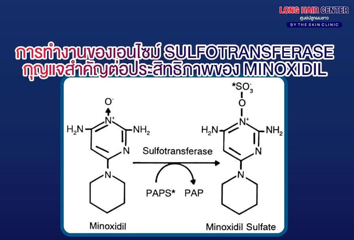 Why Does Topical Minoxidil Work Differently for Each Individual?