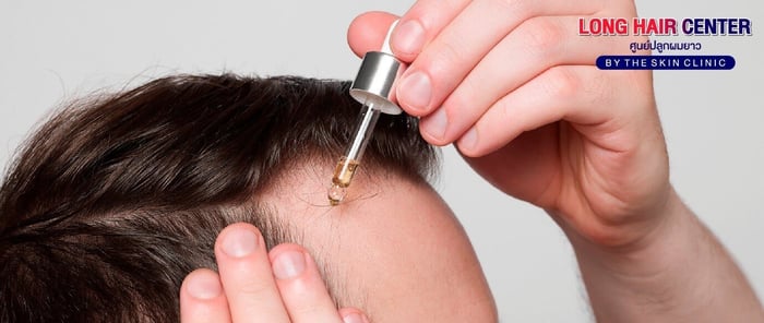 What to Know Before Starting Minoxidil