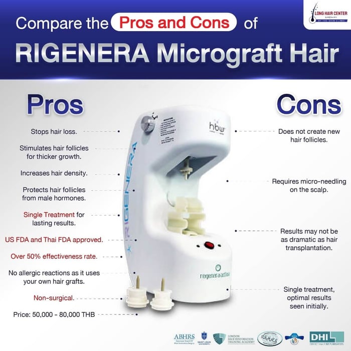 Why Choose the Rigenera Cell Micrograft Hair Technique?