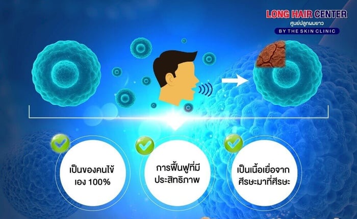 What are the benefits of this technique?