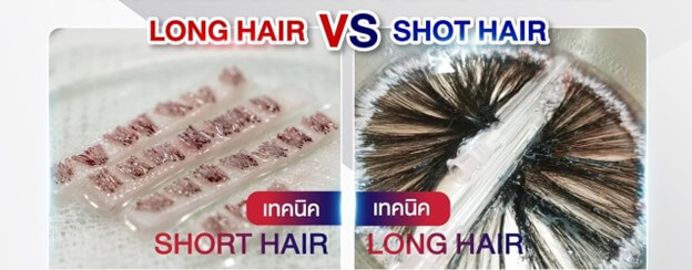 Do different hair types require different graft allocations?