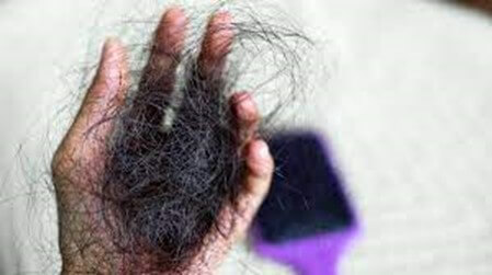 Understand the Root Cause of Hair Loss! Stop relying on online remedies and misconceptions that could worsen the problem!