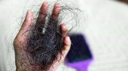 warning-signs-that-you-may-be-going-bald.jpg