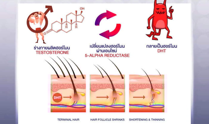 Hair Loss Treatment with siRNA Technology