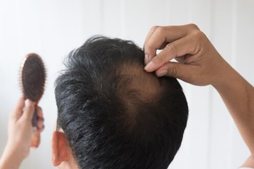 what-causes-thinning-hair-in-the-middle-of-the-head.jpg