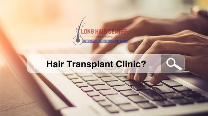 Why Research is Crucial Before Choosing a Hair Transplant?