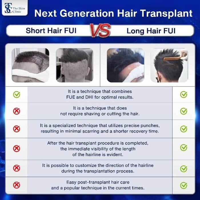 Why should you choose the Long Hair FUE technique for hair transplantation?