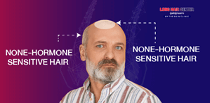 From there, we can divide hair into 2 types as follow.
