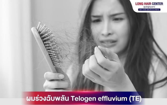 womenhairloss894.jpg