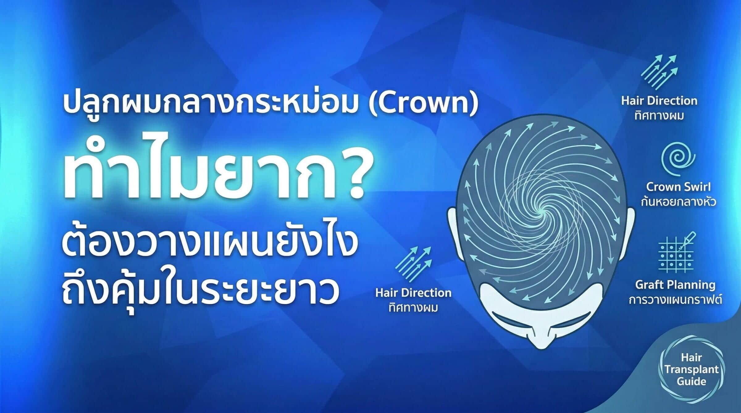 ปลูกผมกลางกระหม่อม (Crown) ทำไมยาก? ต้องวางแผนยังไงถึงคุ้ม