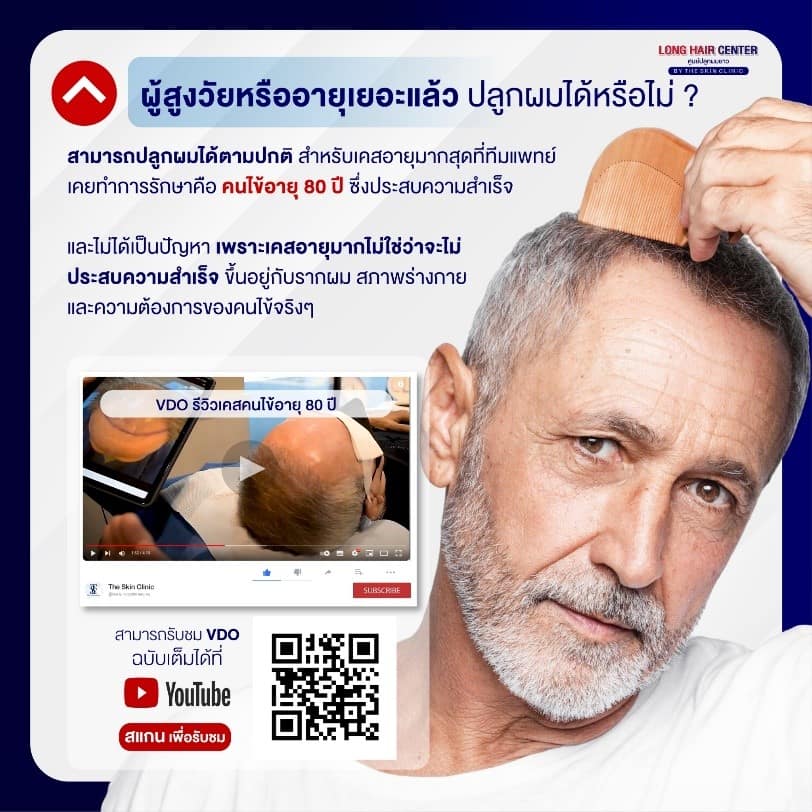 ปัจจัยที่ควรพิจารณาในการตัดสินใจปลูกผม