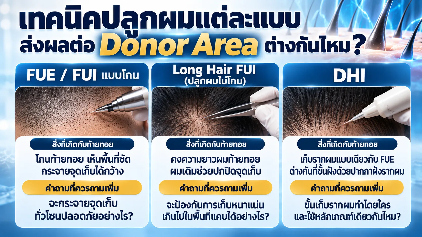 เทคนิคปลูกผมแต่ละแบบส่งผลต่อ Donor Area ต่างกันไหม