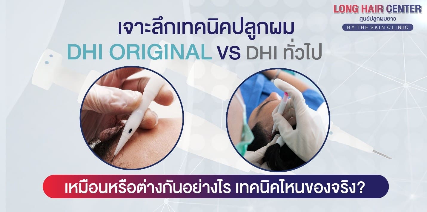 DHI Original VS ปลูกผม DHI ทั่วไป ต่างกันยังไง อะไรคือของจริง?