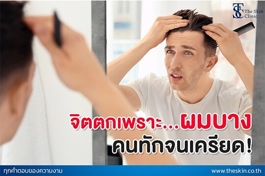 จิตตกเพราะผมบาง คนทักจนเครียด