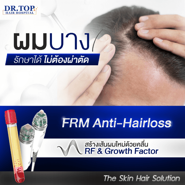 นวัตกรรมรักษาผมบางให้หนาขึ้น โดยไม่ต้องปลูกผม มีการใช้เครื่องมือที่ชื่อว่า Fractional Microneedle RF ทำควบคู่ไปกับการฉีด Premium Growth Factor ซึ่งการใช้ Fractional Microneedle RF จะช่วยกระตุ้นการไหลเวียนเลือดและเพิ่มการดูดซึม กระตุ้นรากผมที่เสื่อมสภาพให้กลับมาทำงาน ทำให้เส้นผมที่งอกใหม่แข็งแรงมากขึ้น ผมเส้นใหญ่ขึ้น
