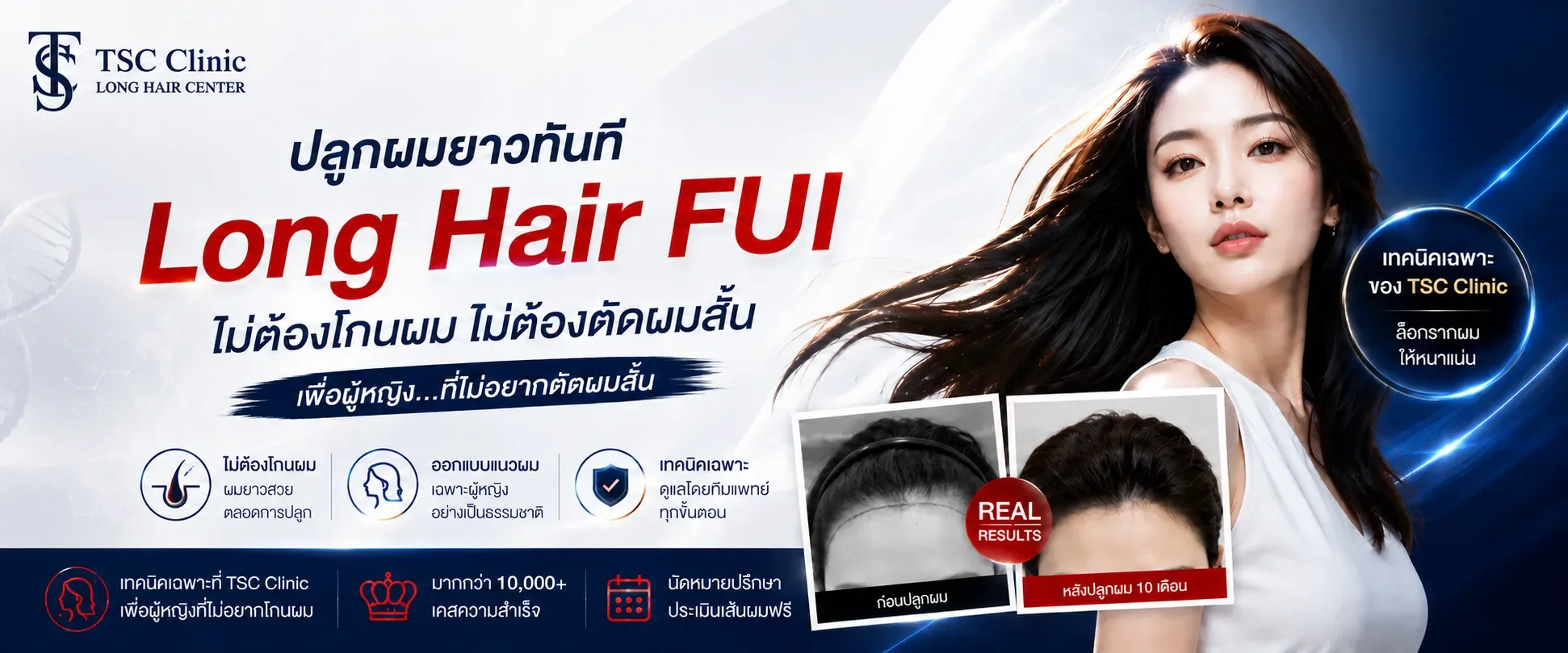 คลิ๊กที่นี่เพื่อ ศึกษาบริการ ปลูกผมผู้หญิง Long Hair FUI เพิ่มเติม