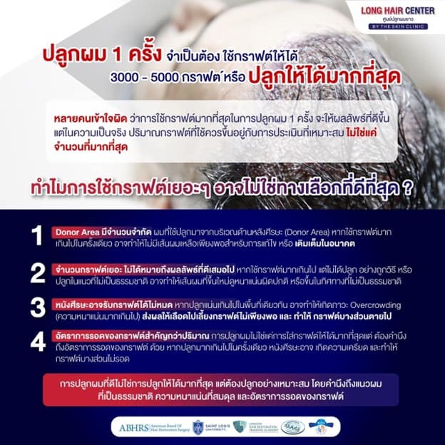 ทำไมการใช้กราฟต์เยอะๆ อาจไม่ใช่ทางเลือกที่ดีที่สุด?