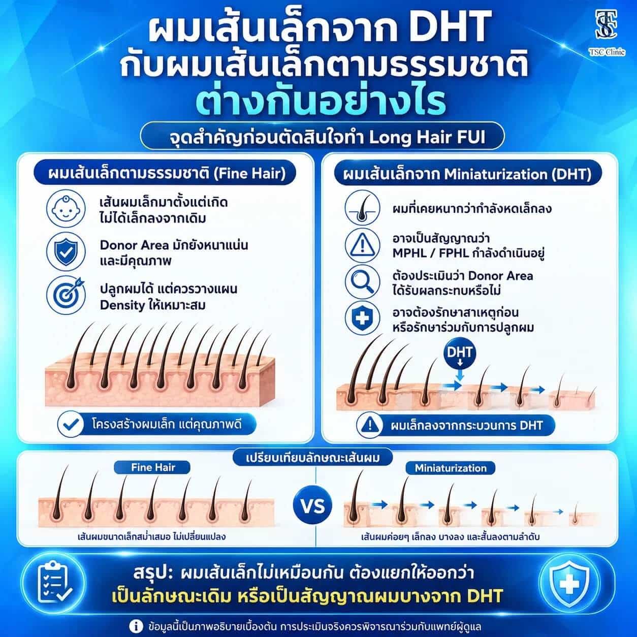 การแยกความแตกต่างผมเส้นเล็กตามธรรมชาติกับ Miniaturization จาก DHT