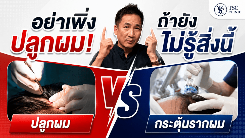 อย่าเพิ่งปลูกผม ถ้ายังไม่รู้สิ่งนี้! ปลูกผม vs กระตุ้นรากผม เลือกแบบไหนดี?