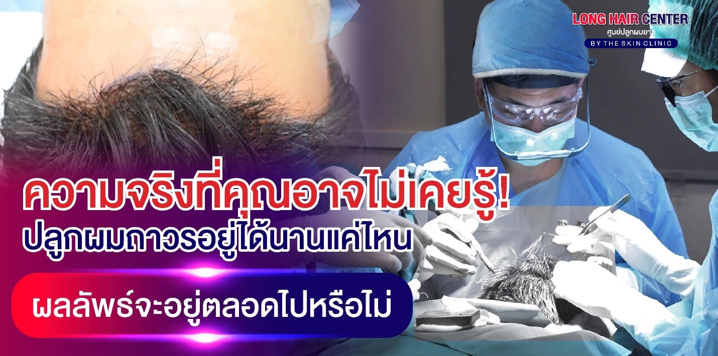 ปลูกผมแล้วต้องกินยาไปตลอดชีวิตหรือไม่?
