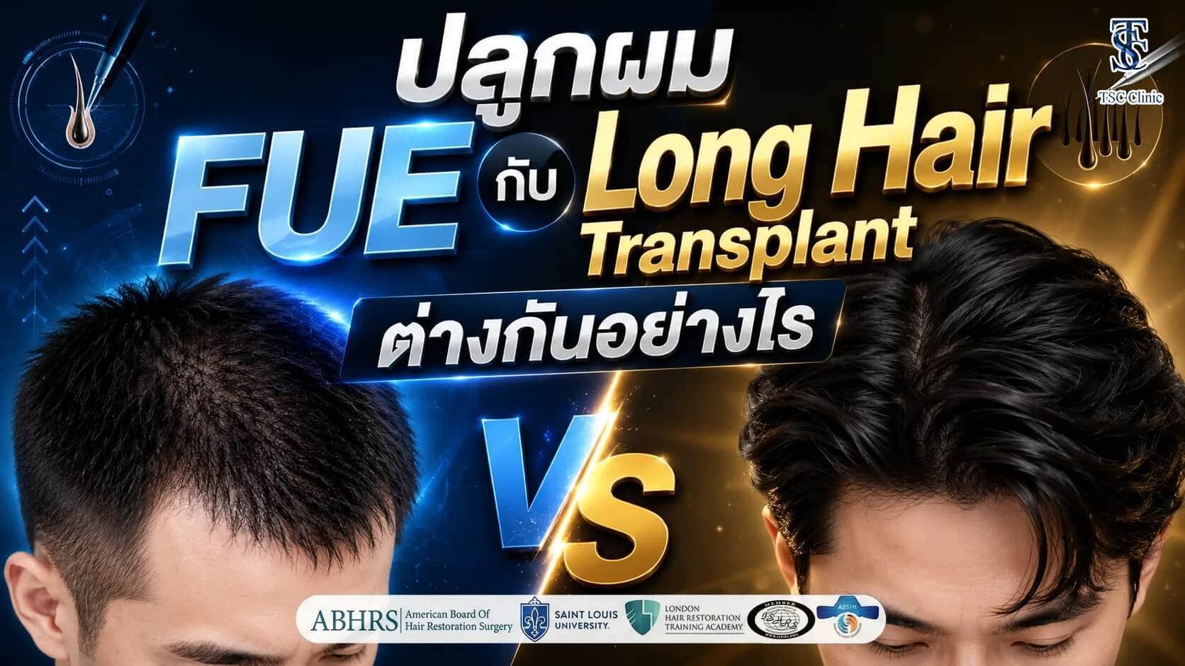 ปลูกผม FUE กับ Long Hair Transplant ต่างกันอย่างไร?