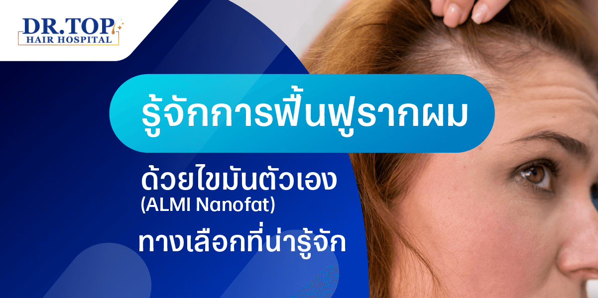 รู้จักการฟื้นฟูรากผมด้วยไขมันตัวเอง (ALMI Nanofat) ทางเลือกที่น่ารู้จัก