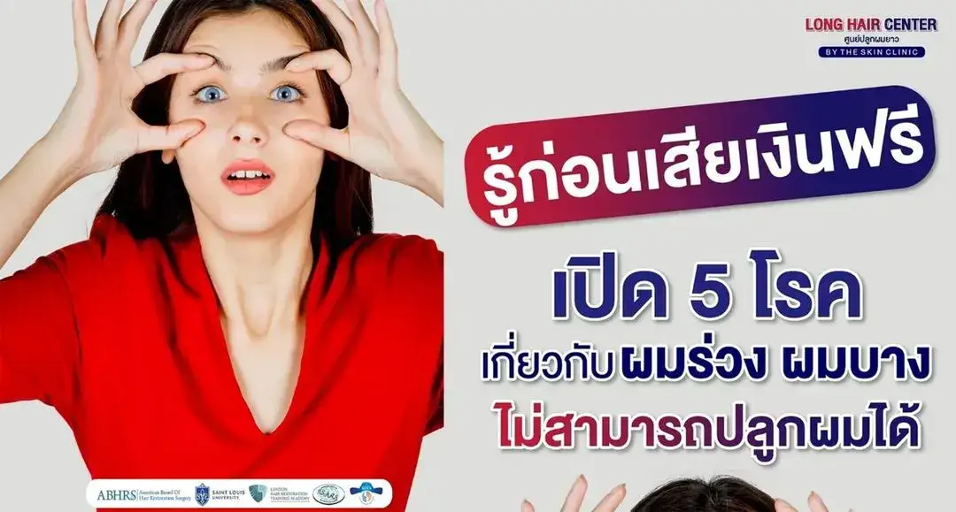 5 โรคประจำตัวที่ไม่ควรปลูกผม! เสี่ยงต่อสุขภาพและผลลัพธ์หลังปลูก