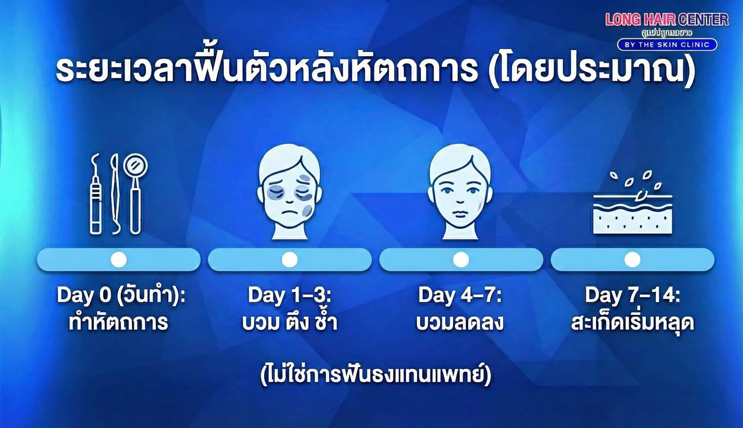 ไทม์ไลน์การพักฟื้นหลังปลูกผม FUE รายวัน ตั้งแต่ Day 0 ถึง Day 14