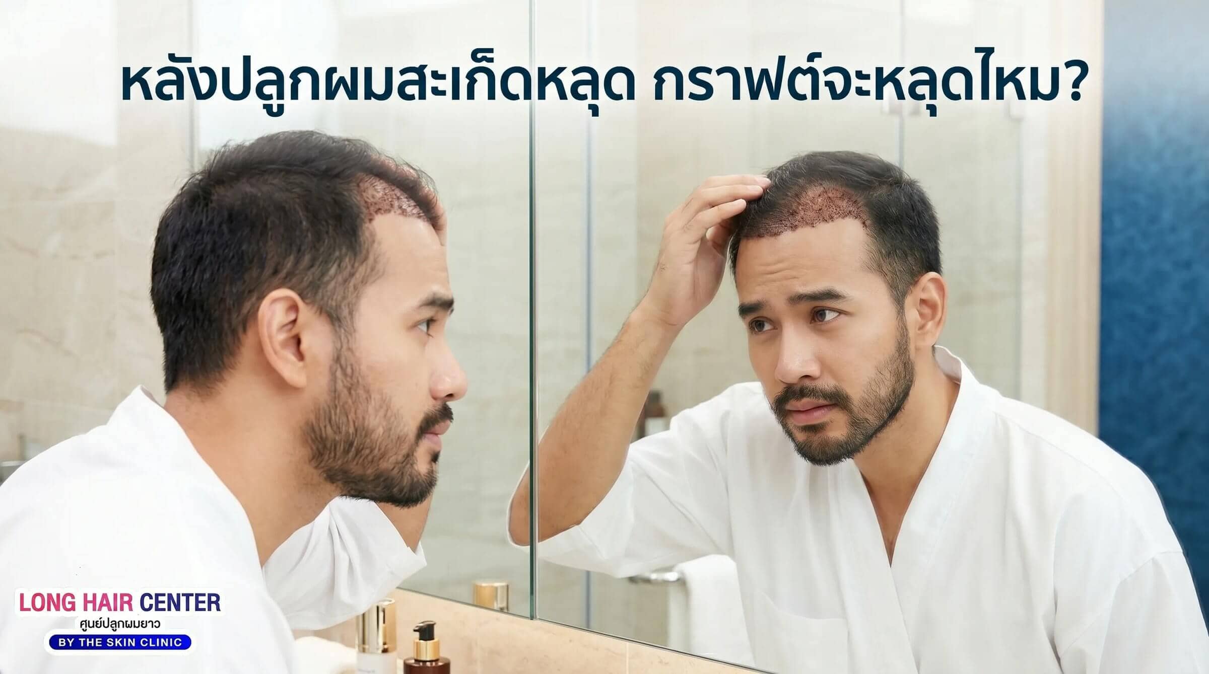 สะเก็ดหลังปลูกผมหลุด กราฟต์จะหลุดไหม?