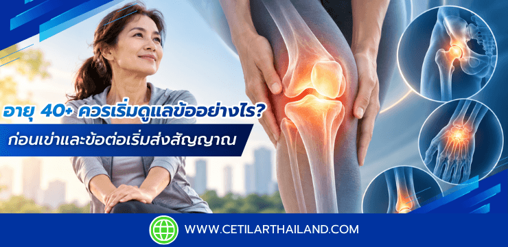 อายุ 40+ ควรเริ่มดูแลข้ออย่างไร? ก่อนเข่าและข้อต่อเริ่มส่งสัญญาณ