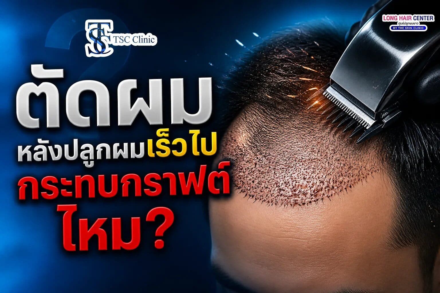 ตัดผมหลังปลูกผมเร็วไป กระทบกราฟต์ไหม
