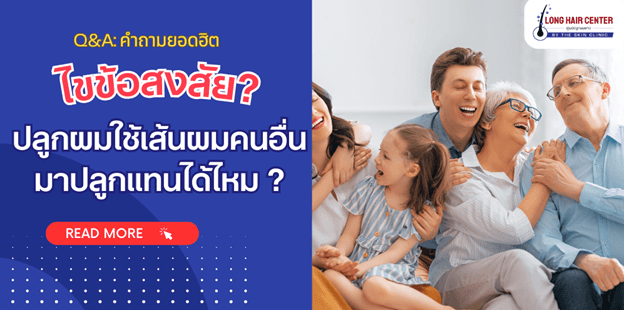 ไขข้อสงสัยเกี่ยวกับการปลูกผม ปลูกผมด้วยเส้นผมของคนอื่นทำได้หรือไม่?