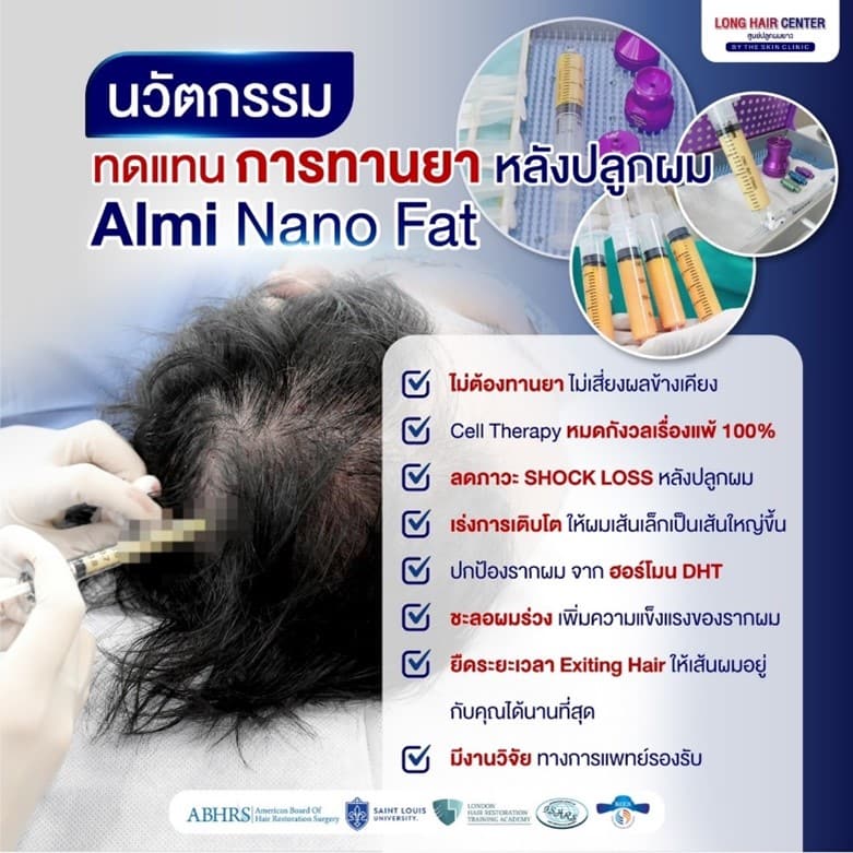 ALMI Nano Fat (Autologous Lipocyte Micronized Injection) 