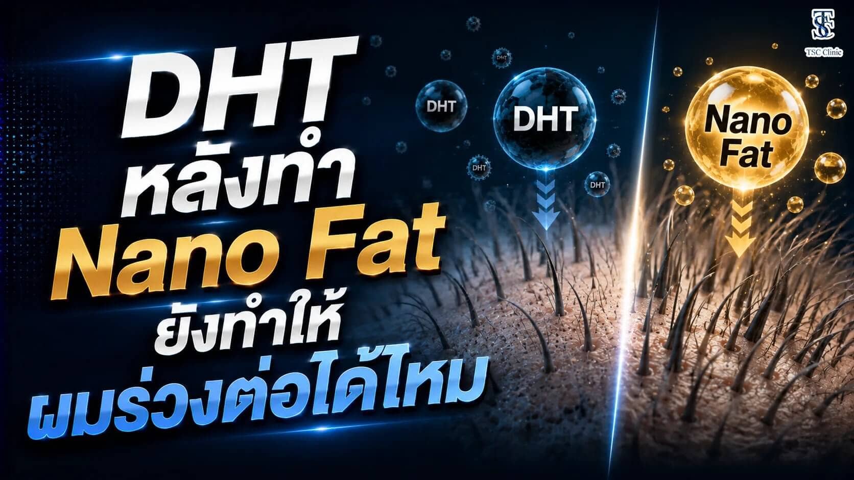 หลังทำ Nano Fat ยังทำให้ผมร่วงต่อได้ไหม