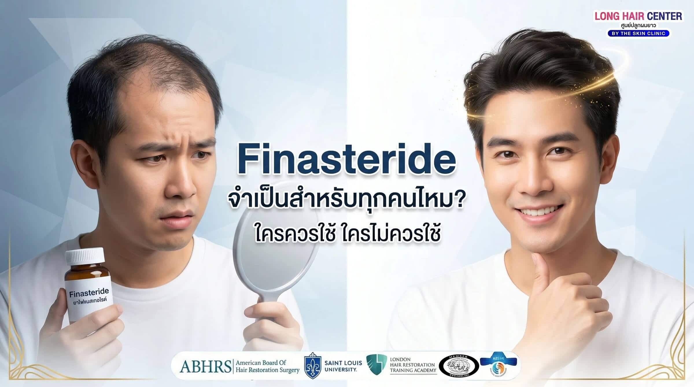 Finasteride จำเป็นสำหรับทุกคนไหม? ใครควรใช้ ใครไม่ควรใช้