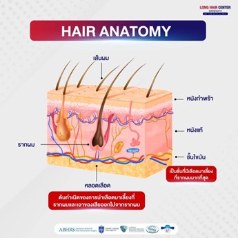 กราฟต์ผม จุดเริ่มต้นสำคัญของการปลูกผม?