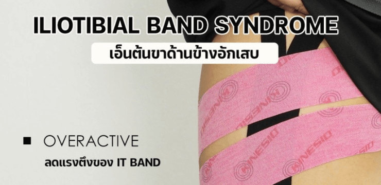 เอ็นต้นขาด้านข้างอักเสบ (Iliotibial Band Syndrome)