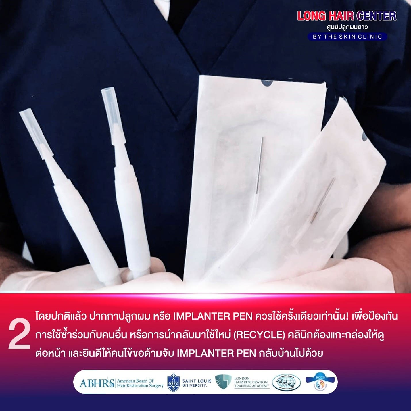 ปลูกผมที่ไหนดี, FUE Hair Transplant
